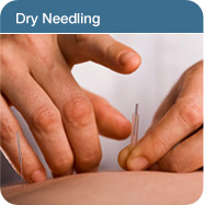 dry needling